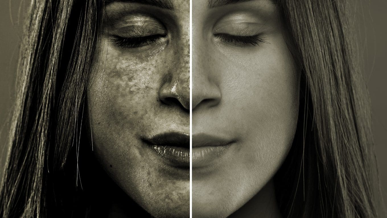 image showing the danger and damage of UV light