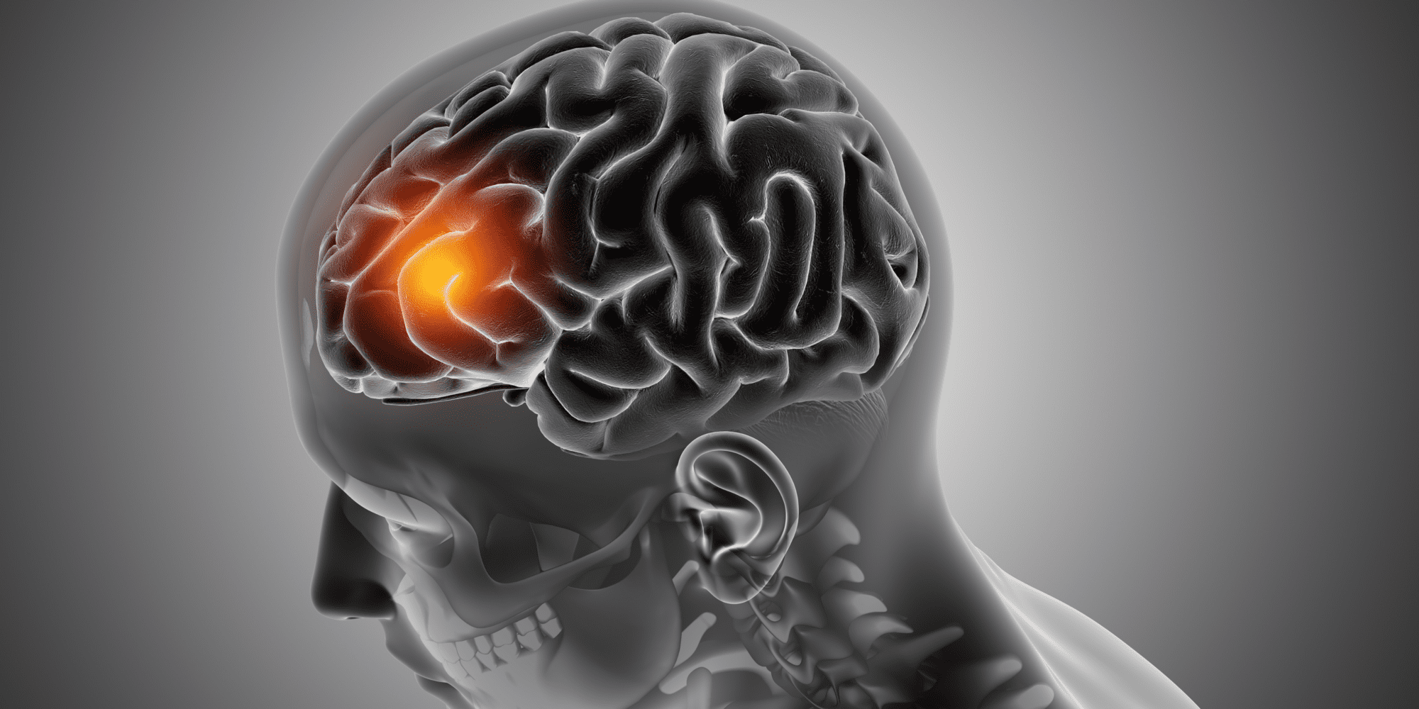 5 Warning Signs of a Brain Tumour